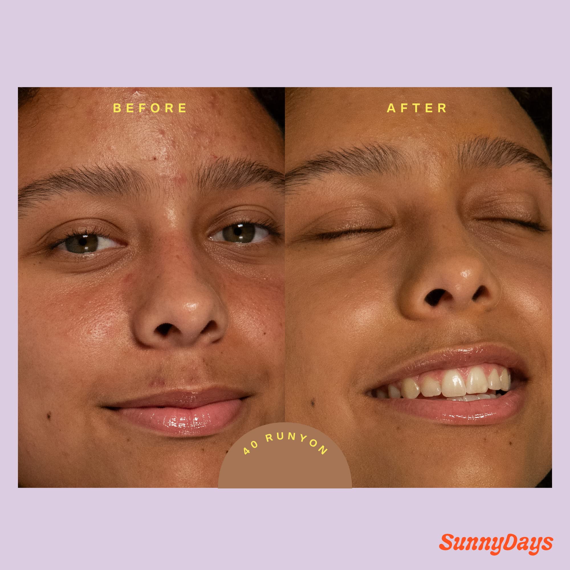 Tower 28 Swipe Serum Concealer in 9.0 + SunnyDays SPF 30 Tinted Moisturizer in 40- Hydrating Medium-Full Coverage Concealer + 2-in-1 Buildable Coverage Foundation + Mineral Sunscreen (2 Count) - Image 5